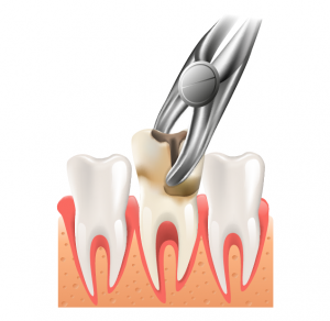 پوسیدگی دندان | پزشکت
