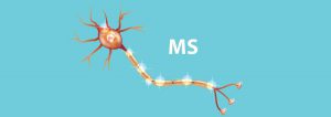 بیماری ام اس (مولتیپل اسکلروز) | پزشکت