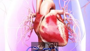 حمله قلبی | پزشکت