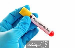 هایپرکالمی | پزشکت