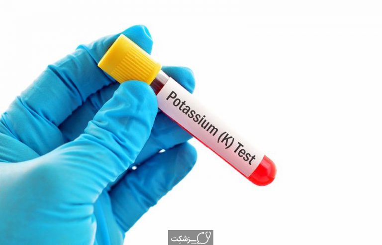 هایپرکالمی | پزشکت