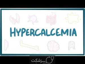 هیپرکلسمی | پزشکت