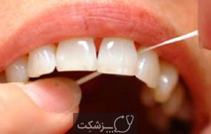 جرم دندان | پزشکت