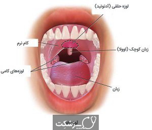 آدنوئید یا لوزه سوم | پزشکت