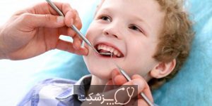 کشیدن دندان شیری | پزشکت