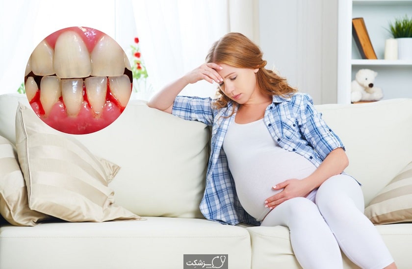 دندان درد در بارداری | پزشکت
