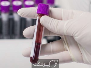 شمارش گلبول های سفید خون | پزشکت