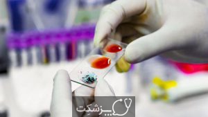 شمارش گلبول های سفید خون | پزشکت
