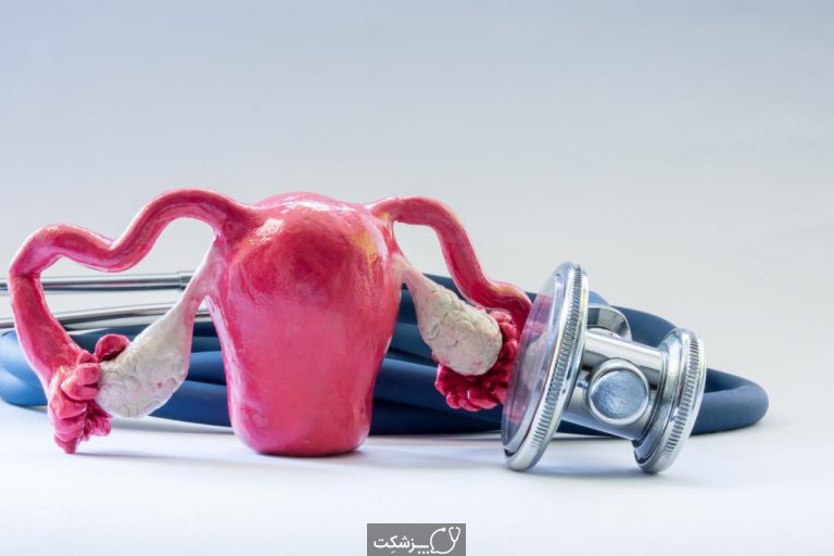 آدنومیوز | پزشکت