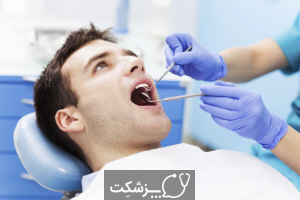 حفره های دندان | پزشکت