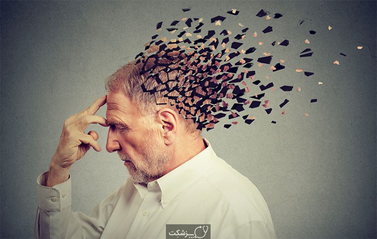 فراموشی | پزشکت