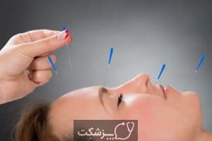 طب سوزنی | پزشکت