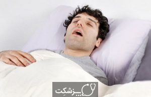 آپنه خواب | پزشکت