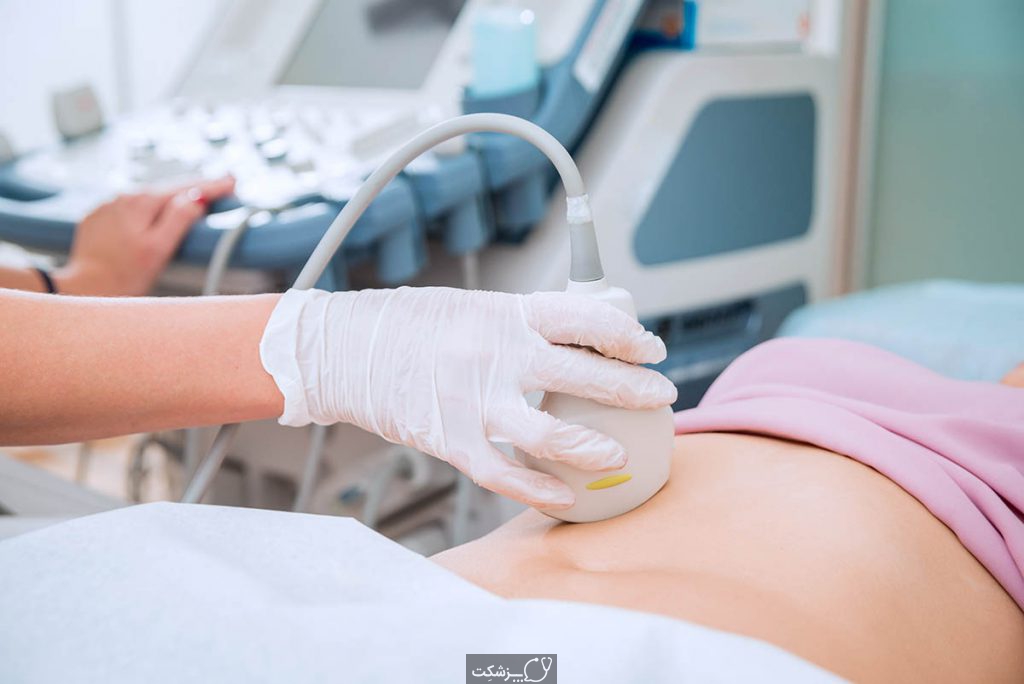 سونوگرافی بارداری-پزشکت