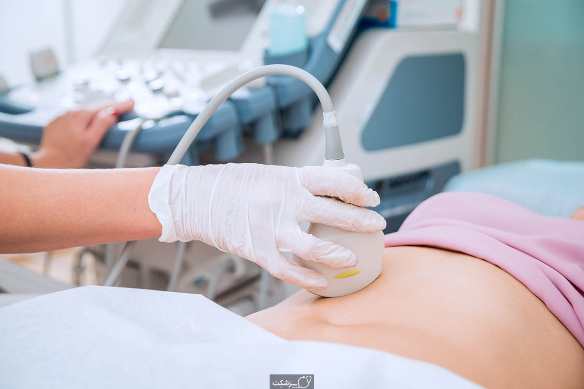 سونوگرافی بارداری-پزشکت