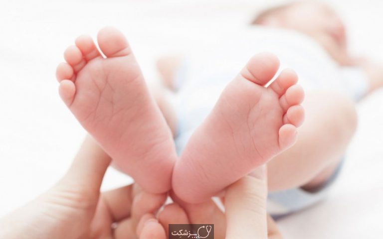 صافی کف پا | پزشکت