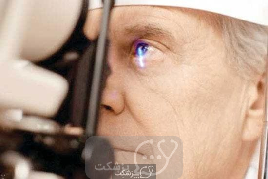 تشخیص خشکی چشم || پزشکت