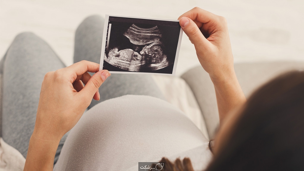 سونوگرافی دوران بارداری | پزشکت
