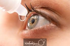 خشکی چشم | پزشکت