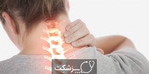 گردن درد | پزشکت