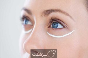 کبودی دور چشم | پزشکت