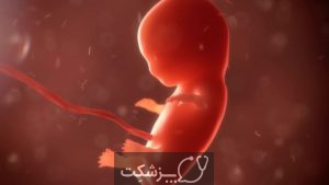 سقط جنین | پزشکت