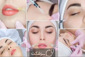 فیلرهای چین و چروک صورت | پزشکت