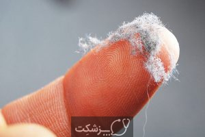 گرد و غبار خانگی | پزشکت