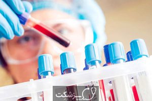 لوسمی سلول مویی | پزشکت