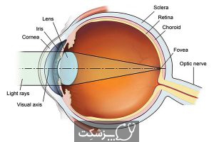 دوربینی چشم | پزشکت