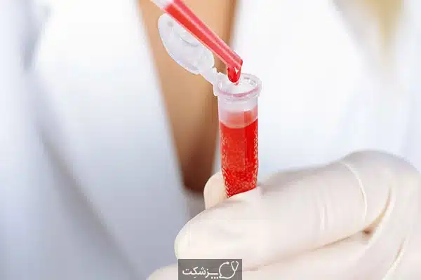 لنفوم | پزشکت