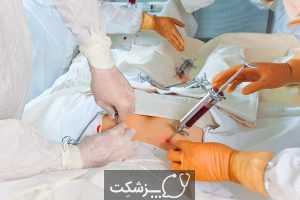 لوسمی حاد میلوژن | پزشکت