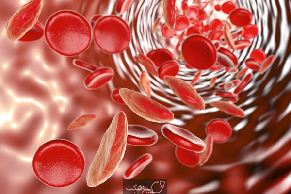 کم خونی سلول داسی | پزشکت