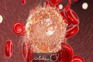 لوسمی سلول مویی | پزشکت