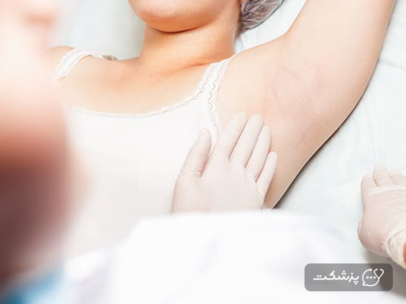 پزشک در حال معاینه توده های زیر بغل