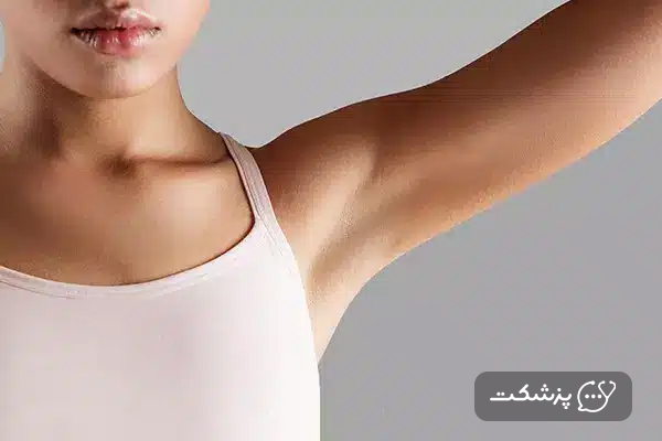 زن جوان با توده های زیر بغل