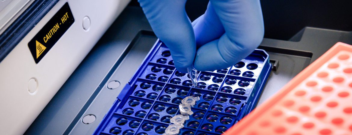 A laboratory worker arranging pipette tips in a blue container for a coronavirus testing A closeup shot of a laboratory worker arranging pipette tips in a blue container for a coronavirus testing