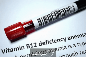 کم خونی ناشی از کمبود ویتامین | پزشکت