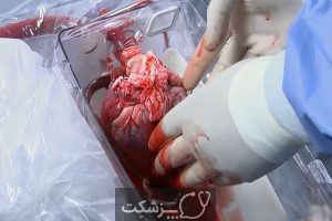 پیوند قلب | پزشکت