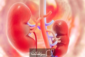 پیوند کلیه | پزشکت