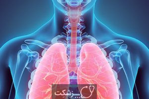 سندرم دیسترس تنفسی حاد | پزشکت