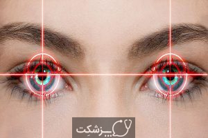 ساختار و عملکرد چشم | پزشکت