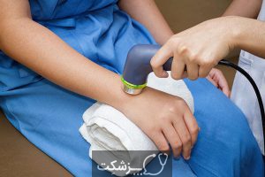 تنگی کانال مچ دست | پزشکت