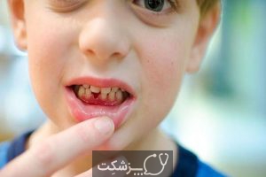 دندان شیری | پزشکت