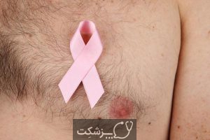 سرطان سینه در مردان | پزشکت