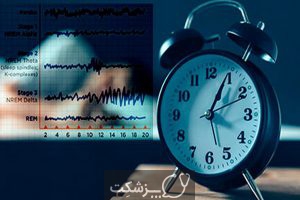 مراحا خواب | پزشکت