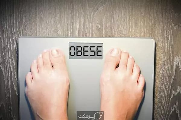 وزن بالا و کیست ساب مندرال-پزشکت