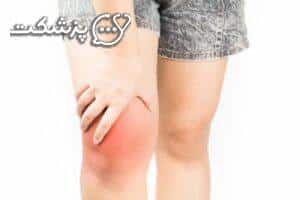 کیست ساب کندرال | پزشکت