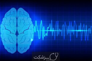 مراحل خواب | پزشکت