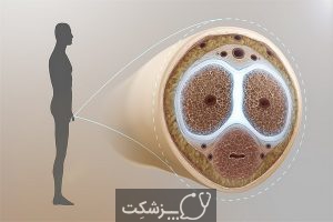 انزال دیررس | پزشکت